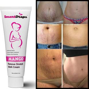smartdrops ScarEase Solution For Men & Women