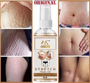 OMSONS Stretch Marks Removal - Natural Heal Pregnancy Breast, , Legs, Mark oil.