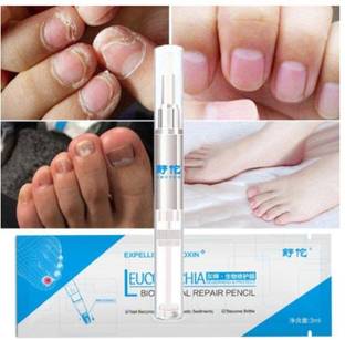 EFERO Nail Fungus Nail Infection Nail Liquid 3ML