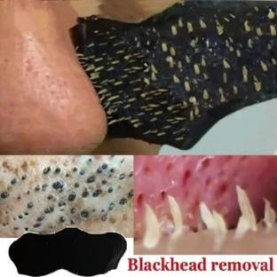tanvi27 Deep Purifying Blackhead Remover Strips for Nose