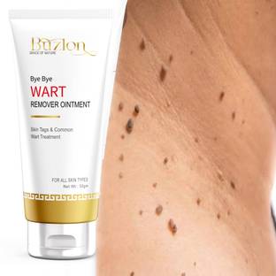 Buzlon Clear Wart Max Formula Wart Cure System