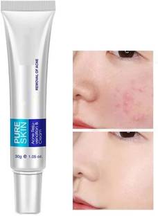 GFSU - GO FOR SOMETHING UNIQUE Anti-Acne Scar Skin Care Face Whitening Cream for Men & Women