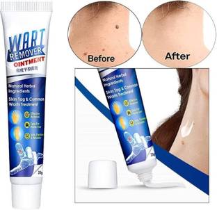marchid Warts Treatment Unique Cream Removal (20 g)