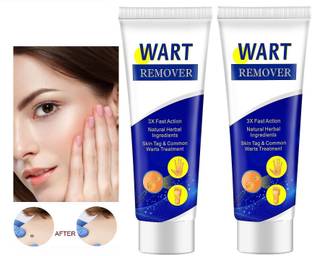 MYEONG Tag And Wart Remover Cream Tube