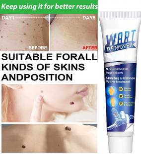 THTC Cream For Wart Remover