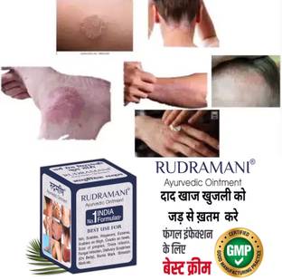 Rudramani Anti-Fungal Skin Infection ,Eczema & Fungal Infection Marham for Skin Care