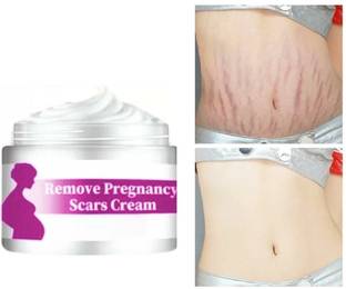 Jiwoo Creme for Bikini Line & Underarms in Women RENOVE SCARS