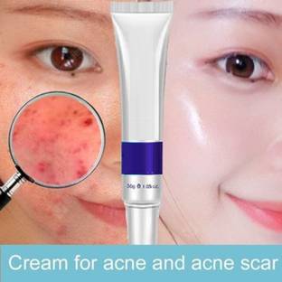 Latixmat Face care Acne Treatment Acne Treatment Cream Shrink pores Oil Control Skin care