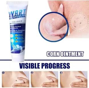 klyish Wart And Mole Vanish Cream Herbal Wart Removal Cream Men & Women