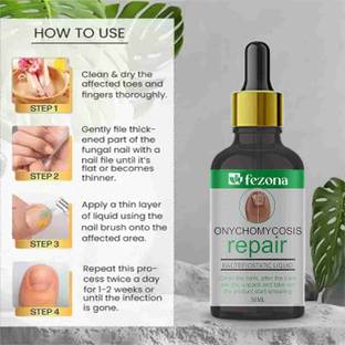 FEZONA Nail Repair Oil Foot Removal Toe Liquid for nails | Supple and Shaped