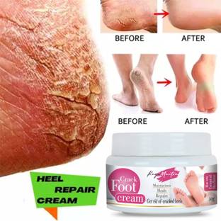 KayaMantra asmine & Green Tea Herbal Foot Crack Cream With Sheabutter