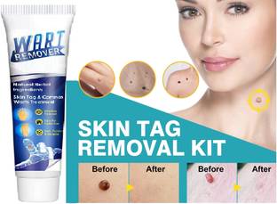 THTC ACNE, MOLES AND SCAR REMOVER CREAM