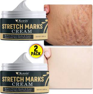 kuraiy Remove Pregnancy Scars Acne Cream Stretch Marks Treatment