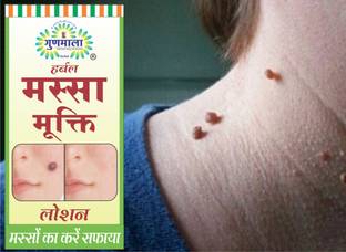 Gunmala Massa Nashak Lotion / Massa Mukti Lotion For Wart Remover - 5 Ml. Pack Of 1