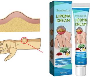 SWELLEDON Lipoma Original Lipoma Lump and Fat Removal Cream