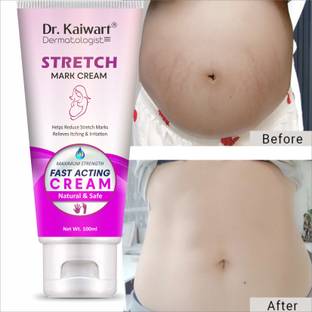 Dr. Kaiwart Stretch Marks & Ageing Signs for Glowing Skin & Stretch mark remover for Stomach