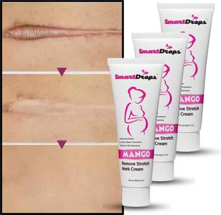 smartdrops Stretch Mark And Scars Repair and Removal Cream
