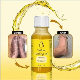 divolife Peeling Oil for Yellow Dark Skin, Extra Strength, Exfoliating Peeling Solution