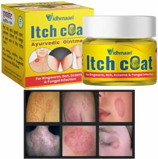Vidhmaan Itch Coat Malam -for Ringworm,Itching & Skin Infection,Fungal,Tretment,Skin Care