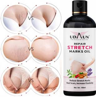 Udaun Pregnancy and Maternity Stretch marks Removal Oil