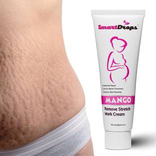smartdrops Stretch Marks Scar removal cream in During after pregnancy