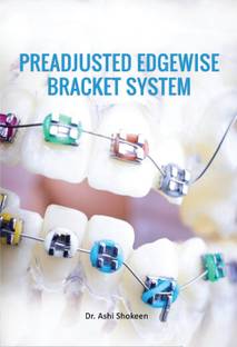 Preadjusted Edgewise Bracket System