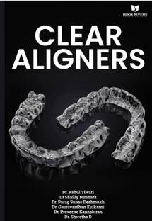 Clear Aligners