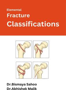 Elemental Fracture Classifications