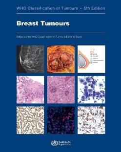 WHO Classification of Breast Tumours