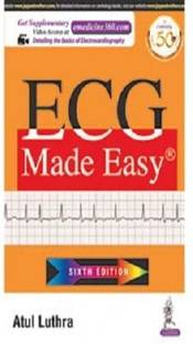 ECG Made Easy