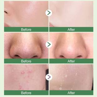 Yuency deep face cleansing oil control mask . Face Wash