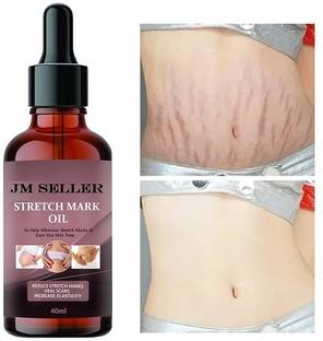 JM SELLER Stretch Marks Remove oil for Pregnancy, Reduce Scars Before & After Pregnancy
