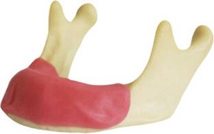 Nexus Medodent Implat Practice Mandible With Gingiva Model(Pack of 1) Dental Implant