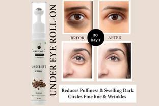 NIRVIKALPA AYURVEDA Coffee Under Eye Cream for Dark Circles | Eye Care, Serum & Roll On