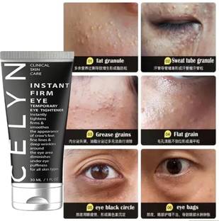 Famire Celyn Eye Cream | Instant Fade Fine Lines Tightens And Smoothes |
