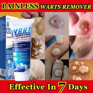 manasona Painless Warts Magic Ointment Original Wart Removal Cream