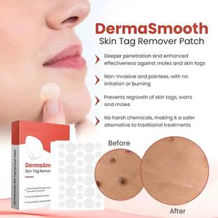 ERVY Derma Smooth Skin Tag Removal Patches - 36 Patches for All Skin Types