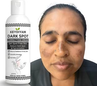 keydiyam DARK SPOT face cream