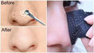 Arcanuy Skin Care Charcoal Blackhead Remover Nose Strips