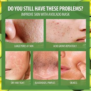 HUZURLU Perfect Green Mask Clay Stick for teenage ,girls and women .