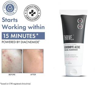 ThriveCo Goodbye Acne Cleanser, Reduces Acne, Marks & Sebum, Moisturising  Face Wash