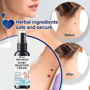 Fezora Wart Treatment Unique Cream Warts Remover Ointment Skin Tag Removal Ointment For Men And Women 50ml Face Wash