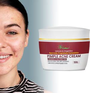 Floarkart Pimple Cream For Oily & Acne Prone Skin Enhances Blood Circulation Of Skin