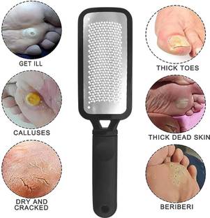 SIYDHA Best Quality Foot Scrubber For Dead Skin Cracked Heels Crack & Callus Remover