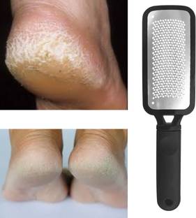SIYDHA Foot Scrubber Tool For Heel Crack Remover , Dead Skin & Heel Repair