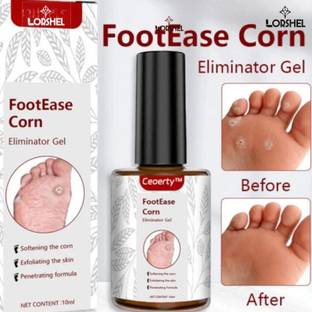 LORSHEL Original Footease Corn Treatment Gel Instant Corn Relief
