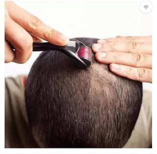 blackyrd 540 Titanium Needles Repairs Damaged Hair Acne Scars Hair Loss