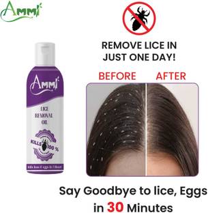 Ammi 100% Natural | Kills Lice, Eggs & Nits | Easy & Safe for Kids Hair Oil