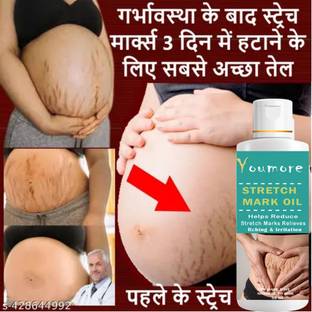 youmore After Delivery Stretch Mark Oil Relieve Marks & Itching & Irritation - 50ml Hair Oil