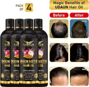 Udaun Onion Methi Hair Oil Pack Of 4 Hair Oil